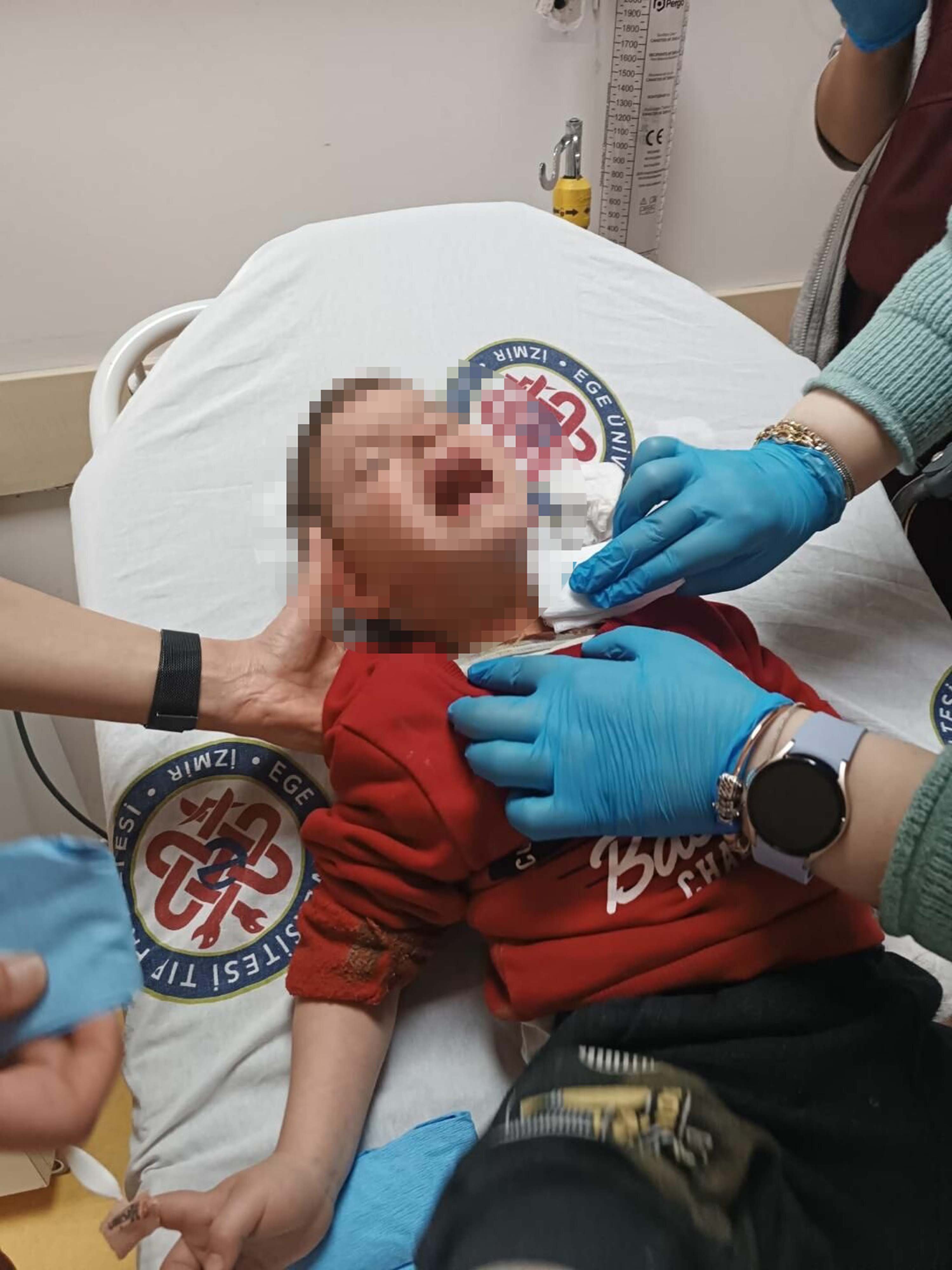 Parkta rastgele bıçak sallayıp, 2 yaşındaki Samet'i boğazından yaralayan şüpheli tutuklandı