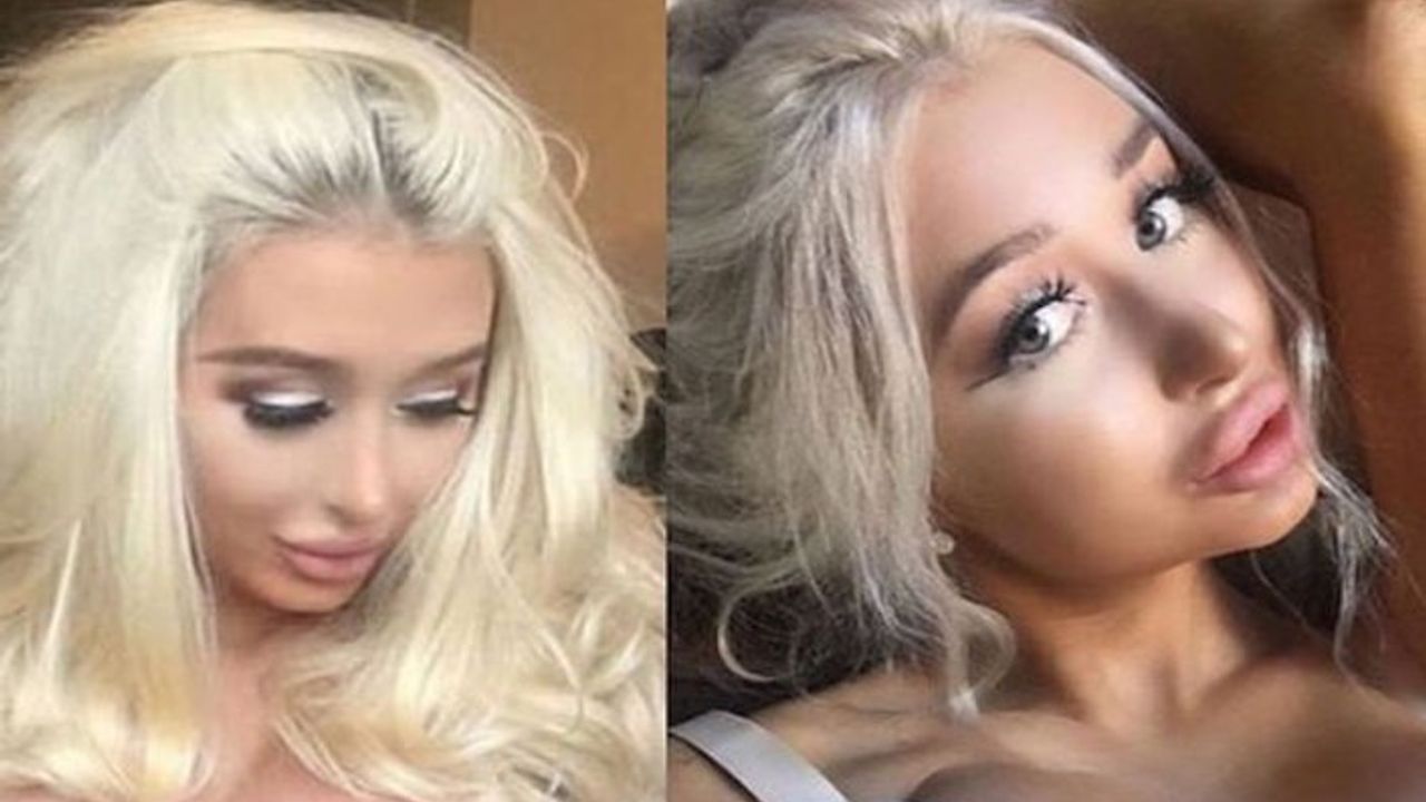 Barbie bebeğe benzemek için defalarca bıçak altına yatmıştı! Estetiksiz hali şoke ediyor