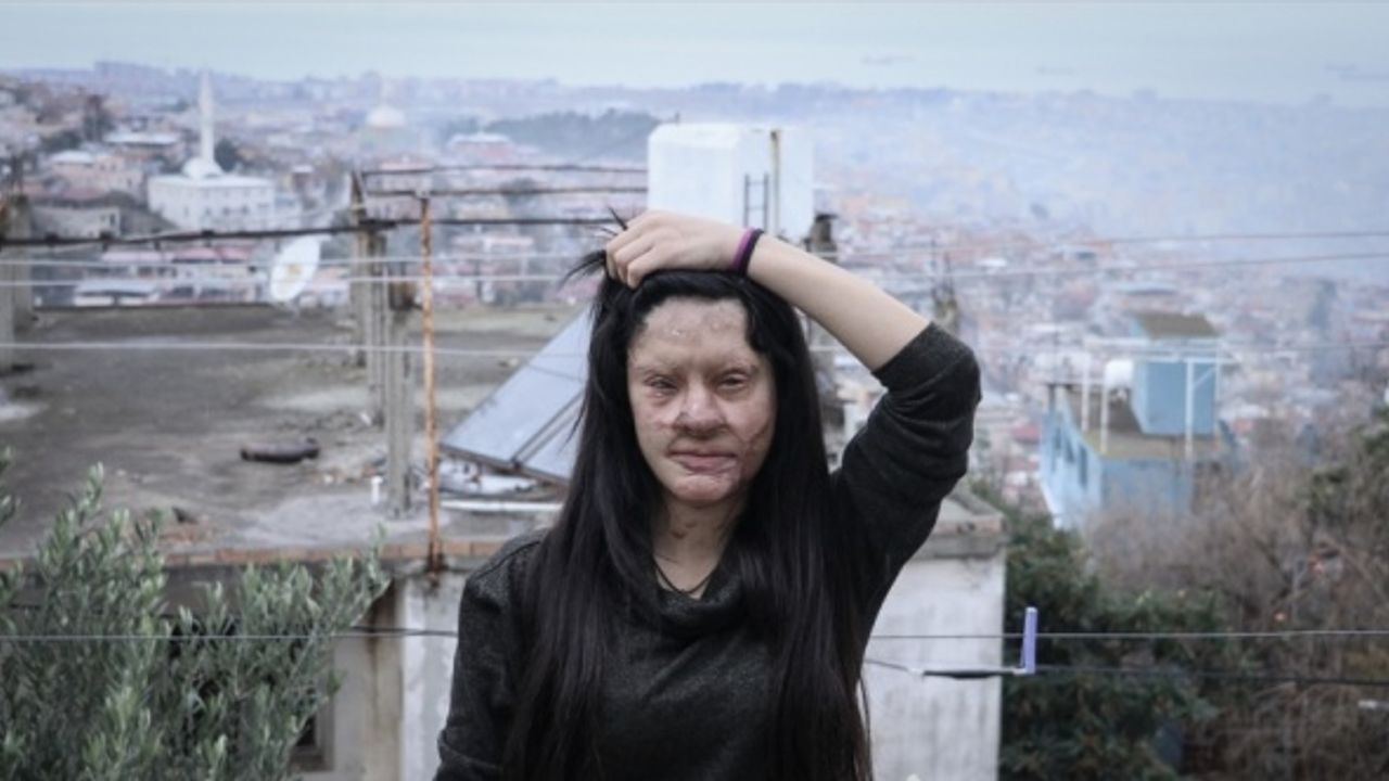 Berfin Özek'ten yüzüne asit döken sanığa verilen cezaya tepki: