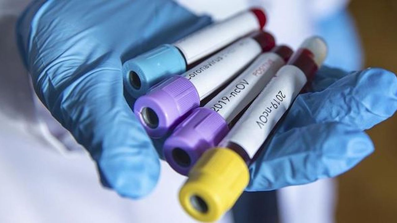 Avusturya'da Kovid 19 mücadelesinde neler oluyor? Çok boyutlu kaosa, özel analiz