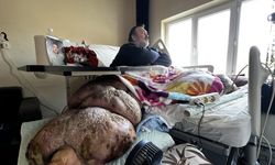 5 yıldır evden çıkamayan 300 kiloya ulaşan fil hastasının hayali; eşiyle kol kola caddede gezmek / Ek fotoğraflar