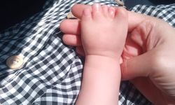 10 ameliyat geçiren yapışık parmak Elif Lina'nın ailesinden çağrı