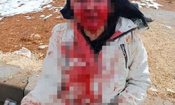 Boşanma aşamasındaki eşini kaldırım taşıyla ağır yaralayan şüpheli tutuklandı