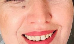 İki yıl her yediğini kusan hastanın operasyon sonrası taze fasulye mutluluğu