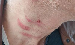 Müezzinin, sıra yüzünden aile hekimini darbettiği iddiası