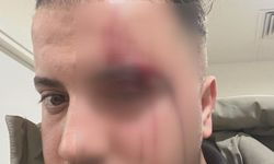 İstanbul- Eyüpsultan'da 'yol verme' kavgasında darbettiği sürücüyü tanımazlıktan geldi