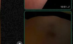 İstanbul - İlişkisini bitirmek istedi darbedilip burnu kırıldı: Yaşamak istiyorum