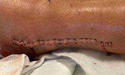 Boşandığı eşinin otomobille ezdiği Hatice: Kaza değil, kasten yapılmış bir şey