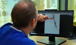 'Erken tanı ve doğru tedaviyle kangrenin önüne geçilebilir'