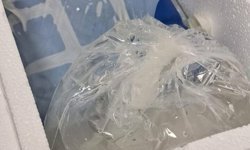 Köpek saldırısına parmağı koptu; o anlar kamerada