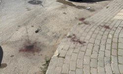 Sokakta tartıştığı kadını, canlı yayında bıçakla kulağından yaraladı