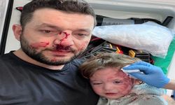 Kucağında bebeği olan babayı darbeden şüpheli adli kontrolle tahliye edildi