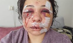 Boşanma aşamasındaki eşini darbeden polis memuruna hapis ve tahliye