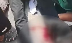 Şişli'de 'Motosikletimi neden çektin' kavgası: Yumruk atan araç sahibini bıçakladı