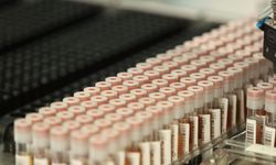 Dünya Kemik İliği Bağışçıları Günü