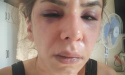 Eşinin şiddet uyguladığı Seda Nur: Ölmek istemiyorum