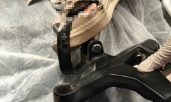 Kazada motosiklet sürücüsünün ayağına demir parçası saplandı