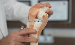 Menisküs kaybına hastanın kendi dokusundan çözüm