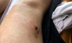Aysel'i sokak ortasında vuran eski eşe verilen cezayı Yargıtay bozdu