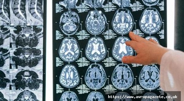 Bilim insanları, ölmekte olan bir insanın beyninin aktivitelerini ilk kez kayıt altına aldı