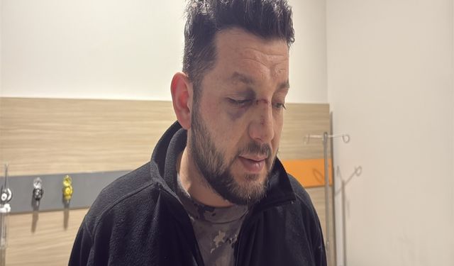 'Çocuk annesinin kucağından düştü, babası kendi burnundaki kanı üzerine akıttı' (2)