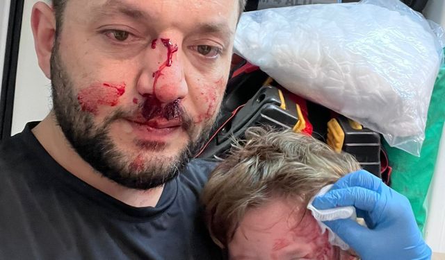 Gürültü tartışmasında komşusu tarafından, kucağındaki 14 aylık bebeğiyle darbedildi