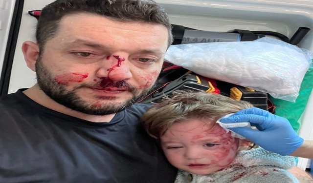 Kucağında bebeği ile darbedilen babanın oğlu, sokakta başına atılan taşla yaralandı