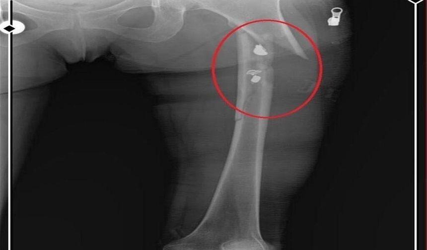 Arkadaşını öldürüp, yaraladığı sevgilisini 21 gün boyunca evinde tutan sanığa müebbet ile 70 yıl hapis