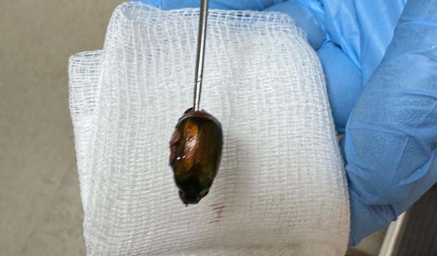 Ağrı ve işitme kaybı nedeniyle gittiği hastanede, kulağından böcek çıktı