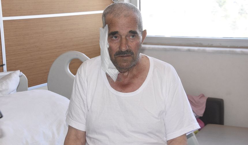 Ameliyatla tükürük bezi tümöründen kurtuldu